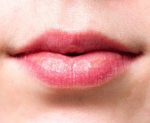 wrinkles-above-the-lips-the-best-treatments-prevention